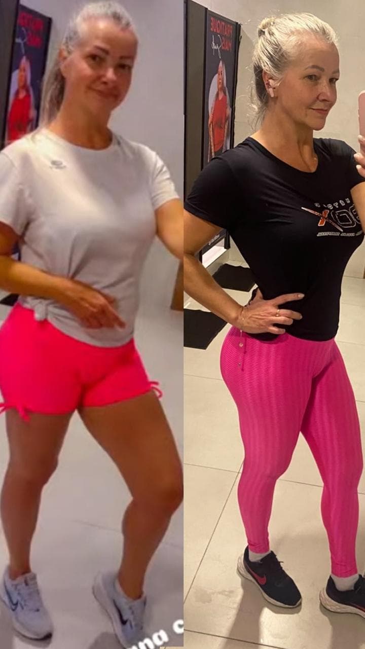 Montagem de dois registros fotográficos de uma mulher, com camiseta clara à esquerda e camiseta preta à direita